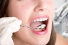 دانلود تصویر کیفیت سیم کشی دندان و دهان باز