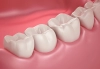 دانلود تصویر کیفیت دندان های فک پایین 