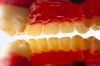 عکس باکیفیت دندان مصنوعی سه بعدی 