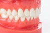 عکس باکیفیت دندان مصنوعی سه بعدی 