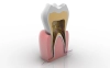 عکس باکیفیت دندان سه بعدی 