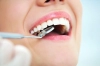 دانلود تصویر کیفیت دندان و اینه دندانپزشکی
