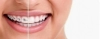 عکس باکیفیت ارتودنسی دندان سه بعدی 