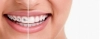 دانلود تصویر کیفیت دندان  و دندان سیم کشی شده 