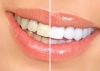 دانلود عکس باکیفیت دندان 
