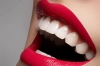 عکس باکیفیت دندان سه بعدی و لبخند