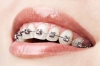 دانلود تصویر کیفیت سیم کشی دندان 