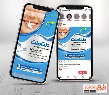 طرح اینستاگرام دندانپزشکی جهت استفاده برای استوری تبلیغاتی و پست اینستاگرامی دندانپزشک