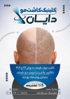 فایل تراکت تراکت مرکز کاشت مو شامل عکس مرد جهت چاپ تراکت تبلیغاتی کلینیک کاشت مو