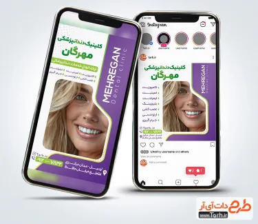 قالب اینستاگرام دندانپزشکی جهت استفاده برای استوری تبلیغاتی