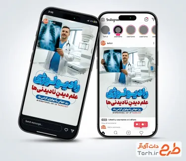 دانلود قالب اینستاگرام روز رادیولوژی شامل عکس پزشک